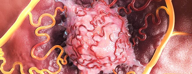 Biomedical illustration built for TriSalus Life Sciences