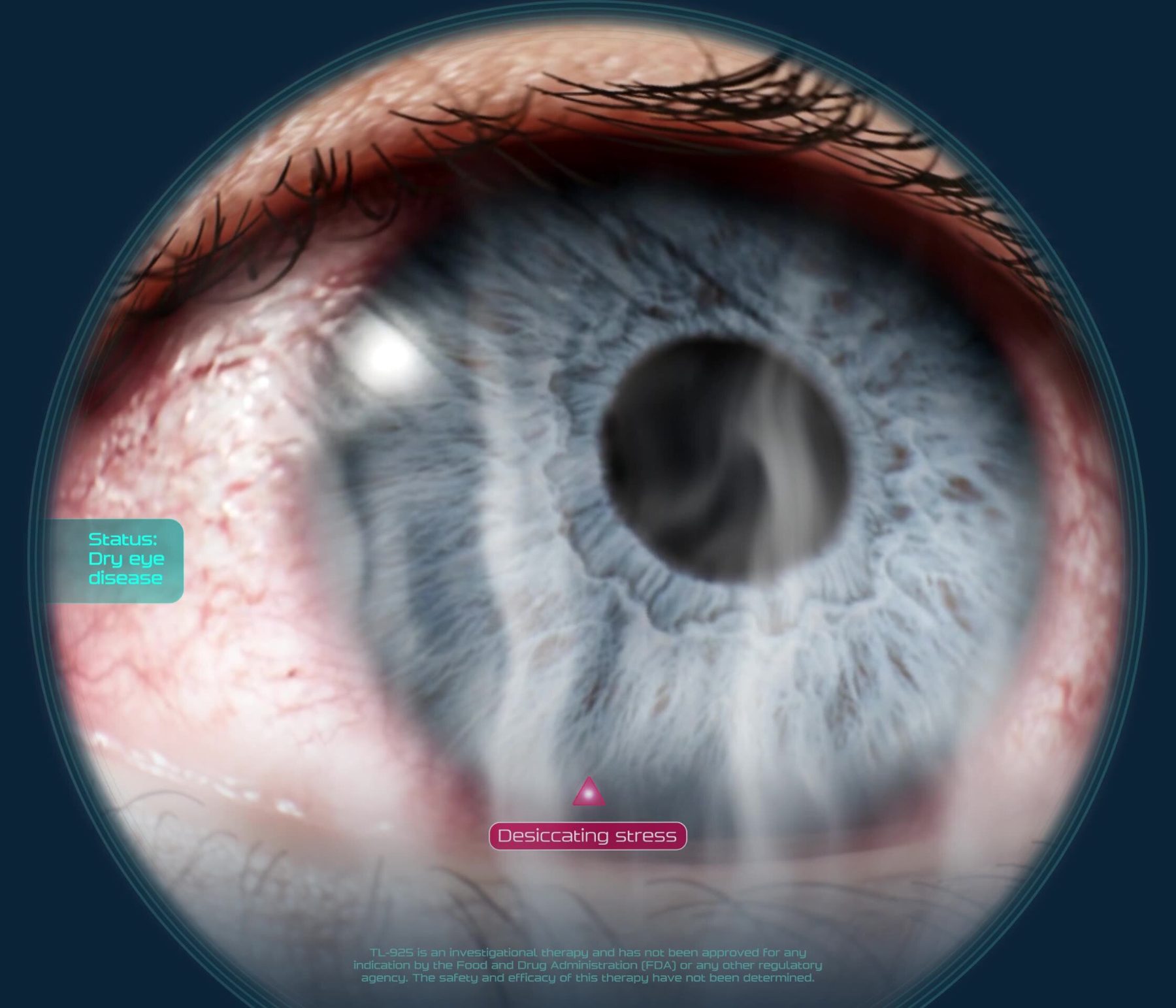 Desiccating stress on the ocular surface