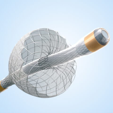The TriNav infusion system with SmartValve