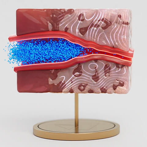 Sectioned tissue model showing therapy perfusing a vessel, from the TriSalus library