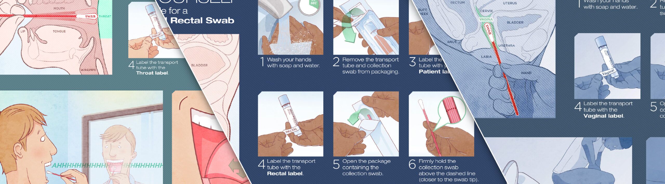UW STI Self Test Visual Guide